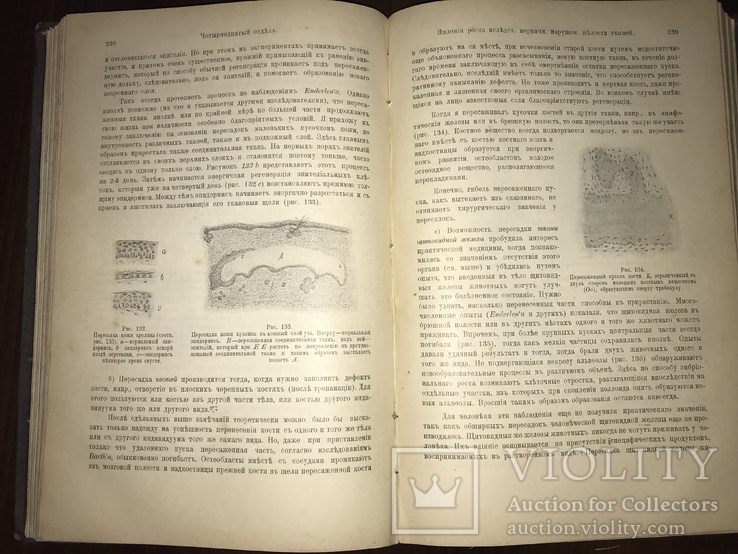 1905 Общая патологическая Анатомия, фото №11