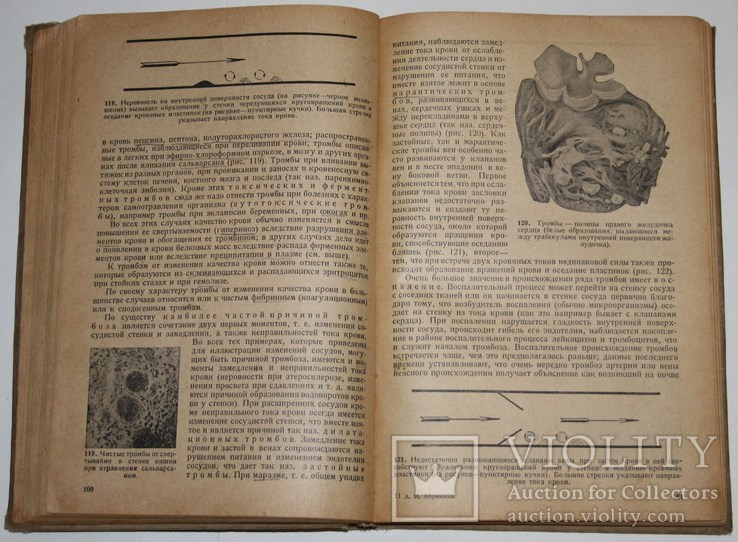 Основы общей патологоанатомической анатомии.,А.И.Абрикосов (1935 год), фото №7