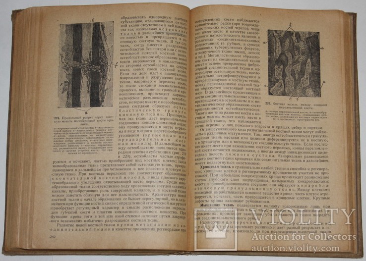 Основы общей патологоанатомической анатомии.,А.И.Абрикосов (1935 год), фото №8