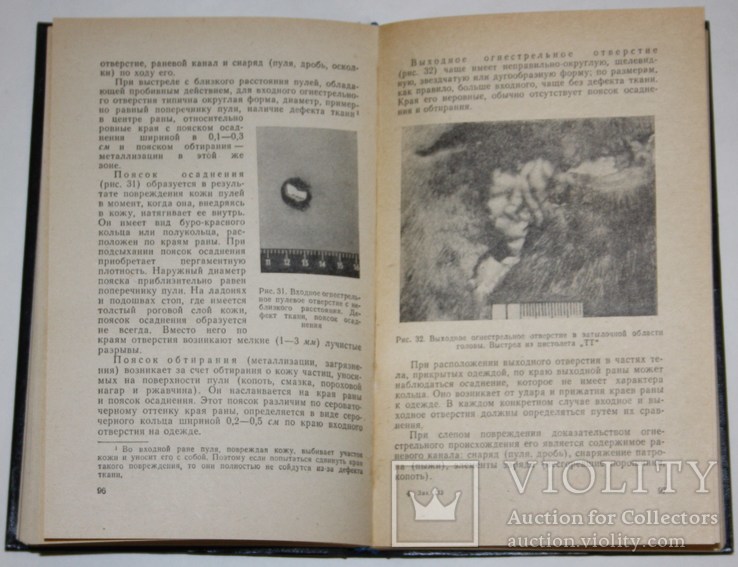 Судебная медицина.,юридическая литература (1974 год)., фото №6