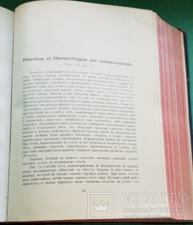 Професор доктор  Ф.Бокенхаймер. Атлас хирургических болезней в их применении 1910 г., фото №13