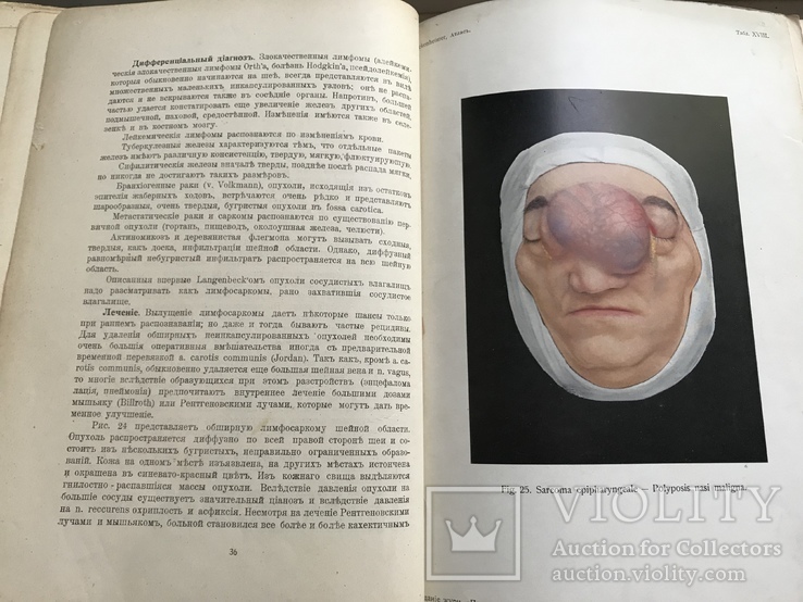 Атлас хирургических болезней применении 1910 года. Профессор доктор Ф. Бокенхаймер, фото №8