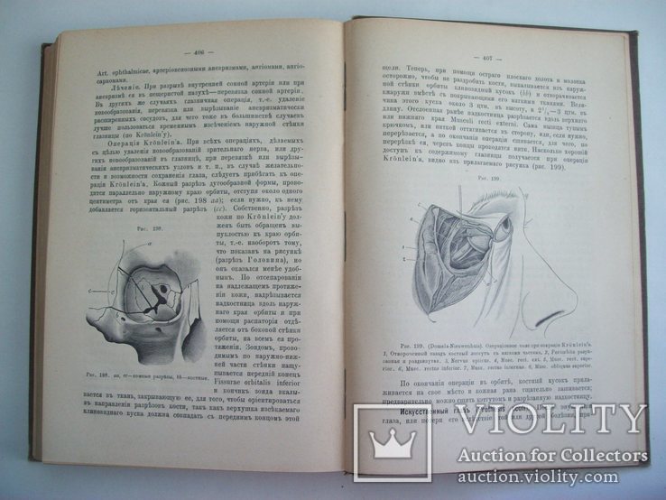 1908 г. "Глазные Болезни" русского д-ра, проф., А. Крюков, фото №13