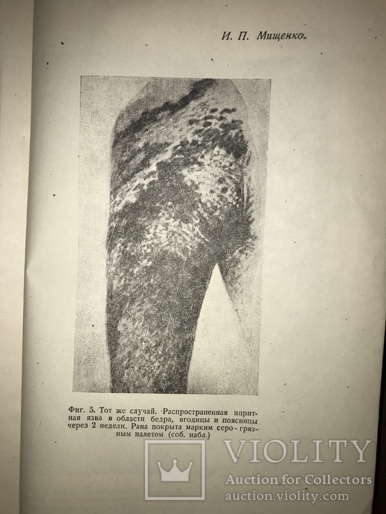 1934 Войсковому врачу при поражении Отравляющими веществами, фото №11
