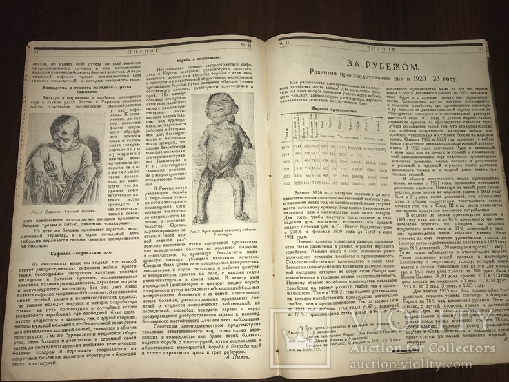 1924 Венерические заболевания Сифилис, Знание 41, фото №13