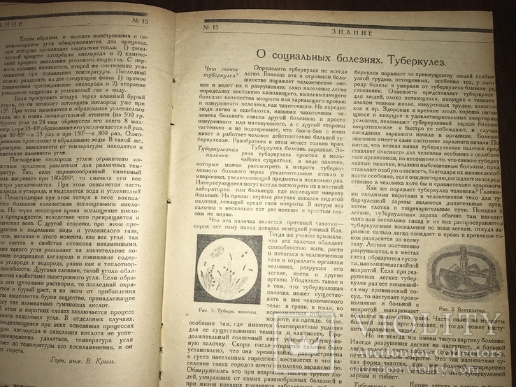 1924 Социальные болезни Туберкулёз, Знание 15, фото №2