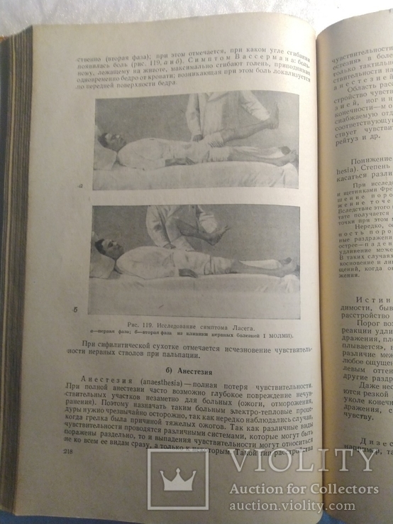 Нервные болезни; Е. К. Сепп, М. Б. Цукер, Е. В. Шмидт; 1950 г., фото №8