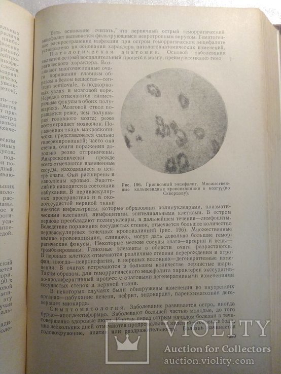 Нервные болезни; Е. К. Сепп, М. Б. Цукер, Е. В. Шмидт; 1950 г., фото №9