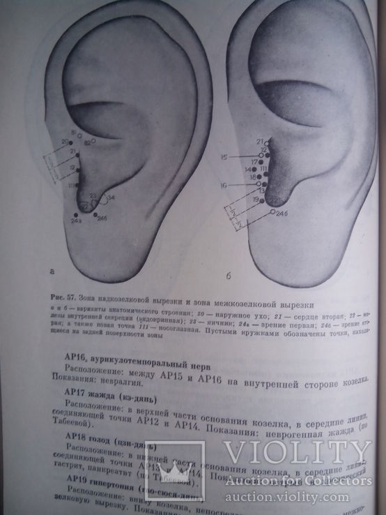 Традиционные и современные аспекты восточной рефлексотерапии, фото №6