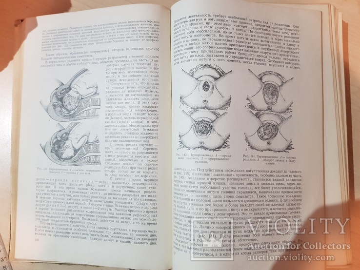 Акушерство А. И. Петченко 1954 год. Руководство для врачей и студентов, фото №10