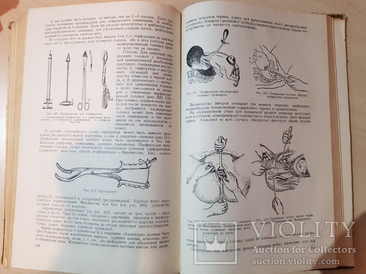 Акушерство А. И. Петченко 1954 год. Руководство для врачей и студентов, фото №11