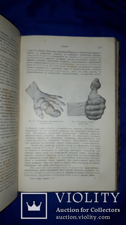1911 Общая хирургия в 2 томах, фото №4