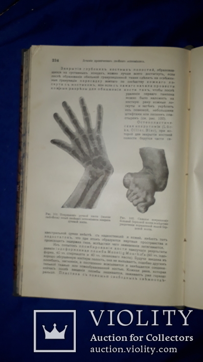 1911 Общая хирургия в 2 томах, фото №5