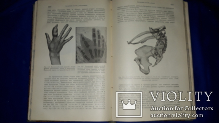 1911 Общая хирургия в 2 томах, фото №9