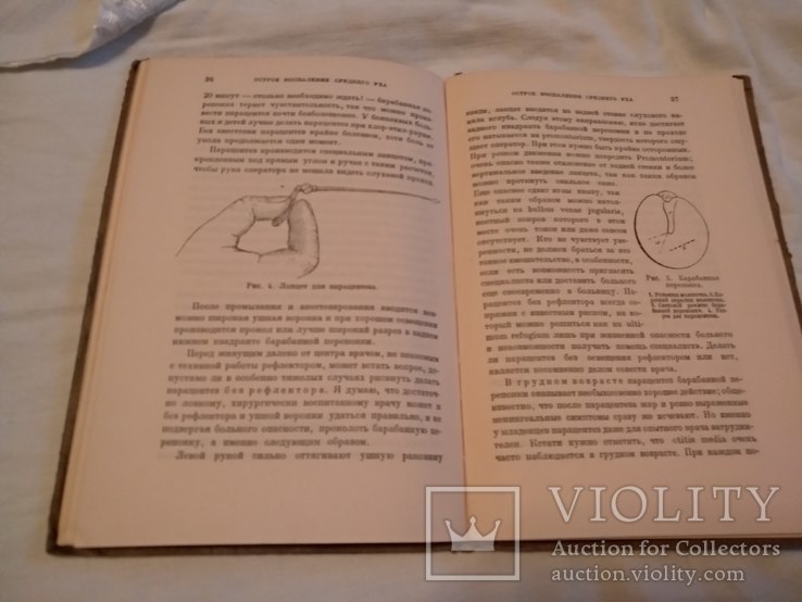 1929 Восполнение среднего уха, фото №8