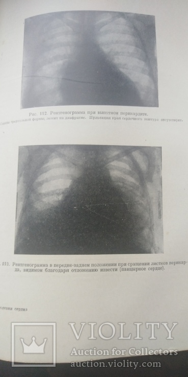 Болезни сердца и сосудов. Л. И. Фогельсон, фото №8