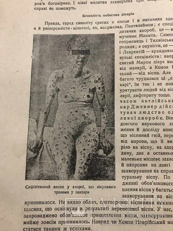 1929 Безвірник я Єврейське свято Сукойс, Здоров`я і сифіліс, фото №2