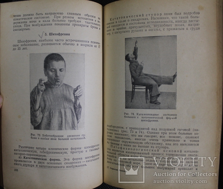 В.Михеев,,Нервние и психические болезни,,1956р., фото №8