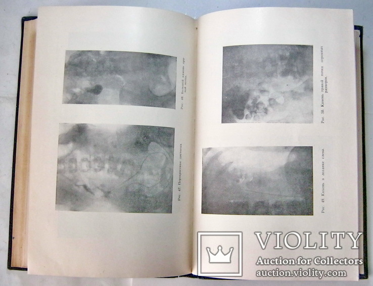 Учебник хирургических болезней 1957 год, фото №6