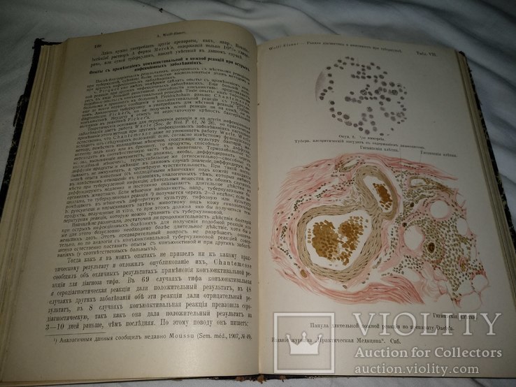 1911 Туберкулёз диагностика имунитет лечение медицина, фото №4