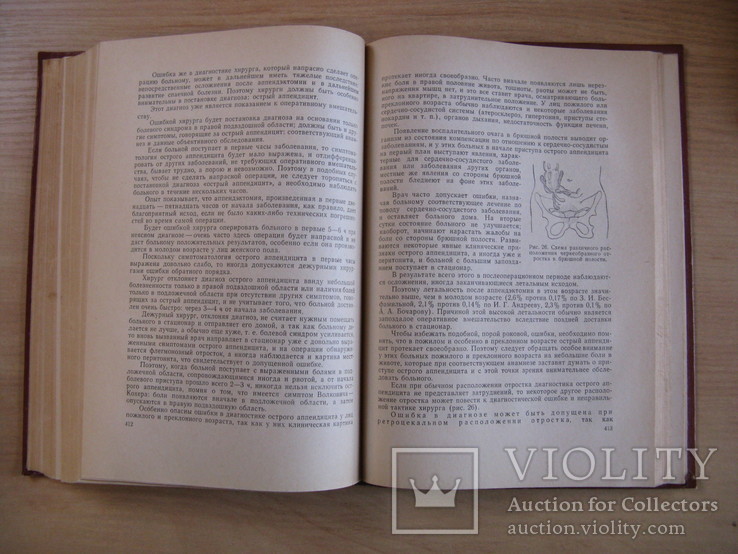 Ошибки, опасности и осложнения в хирургии. 1965г. увеличенный формат., фото №5