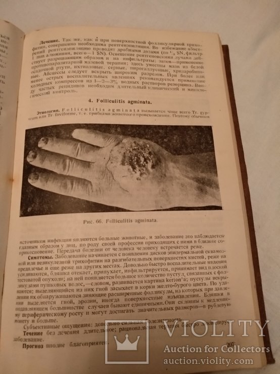 1933 Кожные болезни П. Григорьев, фото №12