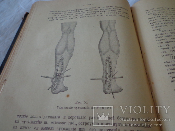 Курс хирургической терапии 1902 год., фото №9