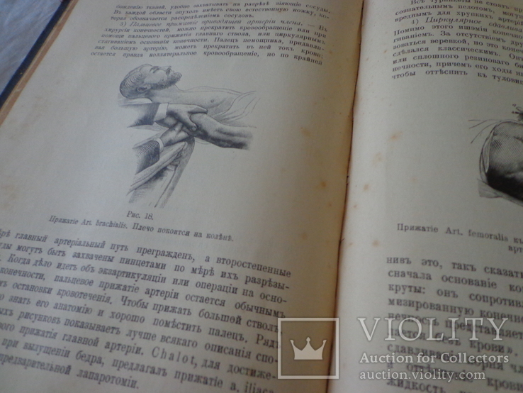 Курс хирургической терапии 1902 год., фото №11