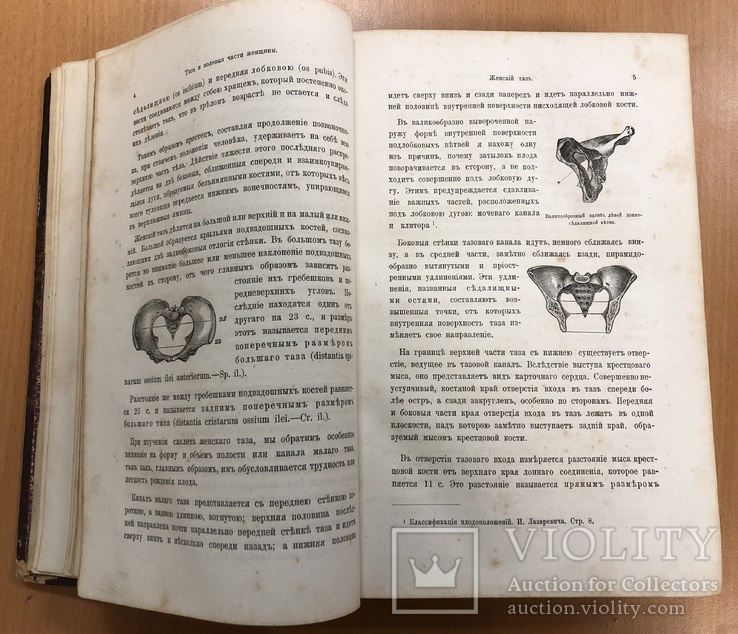 Лазаревич. Курс акушерства. 1879 год. Харьков., фото №11