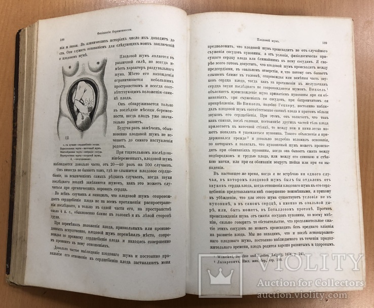 Лазаревич. Курс акушерства. 1879 год. Харьков., фото №12