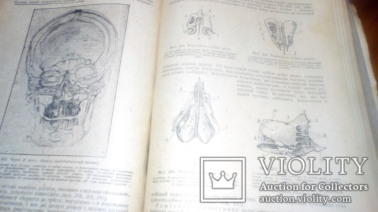 Анатомия людини с иллюстрациями 1939г, фото №11