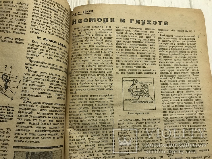 1932 Насморк и глухота: Гигиена и здоровье, фото №13