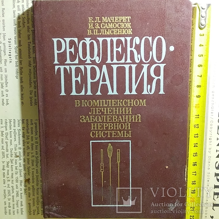 Мочерет "Рефлексотерапия в лечении нервной системы" 1989р., фото №2