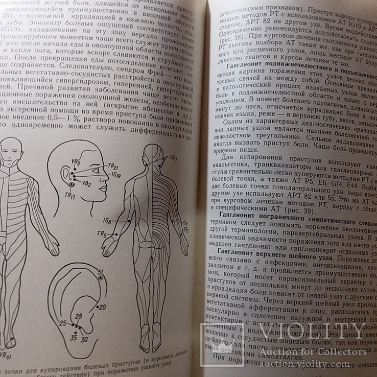 Мочерет "Рефлексотерапия в лечении нервной системы" 1989р., фото №5