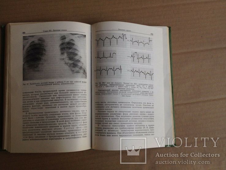 Руководство по пульмонологии детского возраста. 1978, фото №8