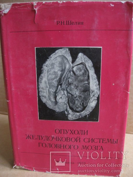 Опухоли желудочковой системы головного мозга. 1973, фото №2