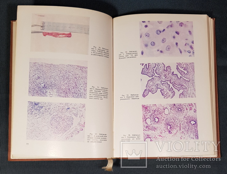 Атлас анатомо-эндокринологических половых аномалий развития, фото №9
