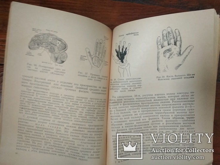 "Панариций и его лечение".Профессор А.Н.Рыжих.На базе методов Вишневского.1950г.Т.8000., фото №8