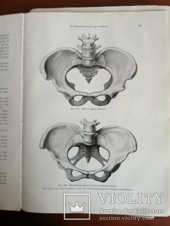 Акушерство и Гинекология на немецком 1920 года, фото №13