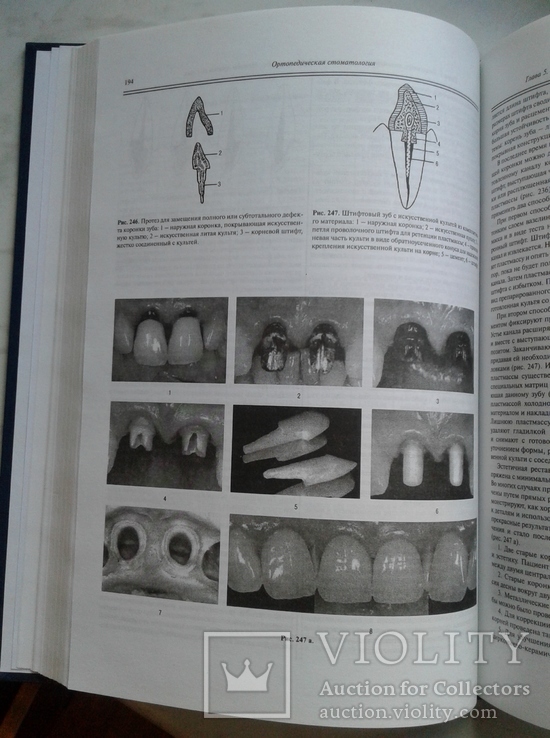 Ортопедическая Стоматология. Аболмасов Н., фото №5
