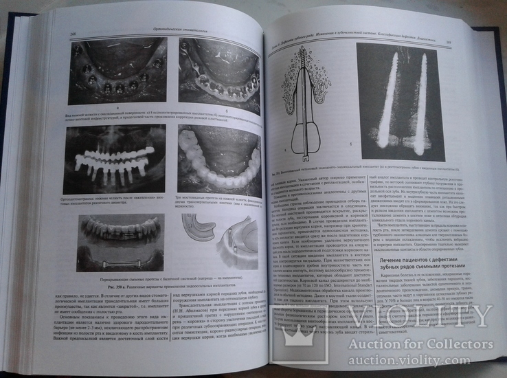 Ортопедическая Стоматология. Аболмасов Н., фото №8