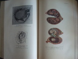 Акушерство,руководство для врачей и студентов,А.И.Петченко 1965г. тир.25тыс., фото №6