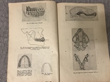Протезна Стоматологія 1920ті р 415 Малюнків, фото №6