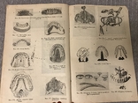 Протезна Стоматологія 1920ті р 415 Малюнків, фото №10