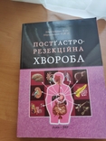 Постгастрорезекційна хвороба Абрагамович О.О., numer zdjęcia 2