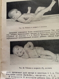 Пропедевтика детских болезней. 1955г., фото №4