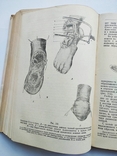 1938 Курс оперативной хирургии В.Шевкуненко 1-й том, фото №12