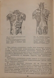 Мануальна, гомеопатична та рефлексотерапія остеохондрозу хребта. Самосюк І. З., фото №3