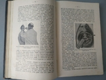 1913 год Медицина отиатрия, фото №11