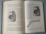 1913 год Медицина отиатрия, фото №13